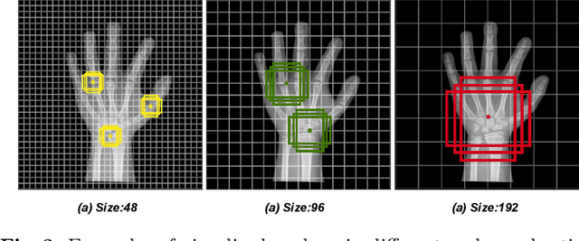 Figure 4 for PRSNet: Part Relation and Selection Network for Bone Age Assessment