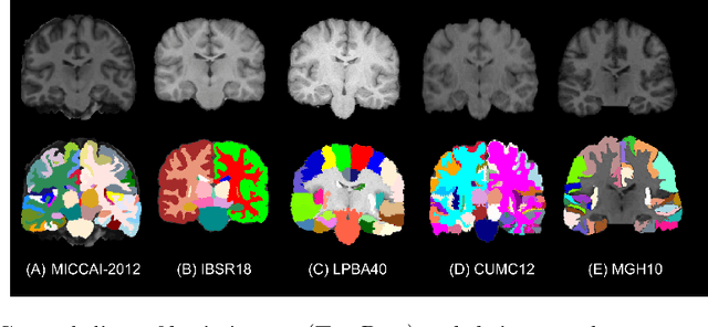 Figure 3 for To Learn or Not to Learn Features for Deformable Registration?