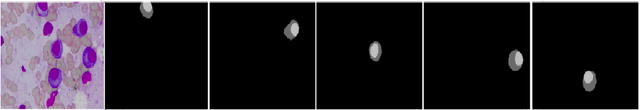 Figure 1 for Transformer Assisted Convolutional Network for Cell Instance Segmentation