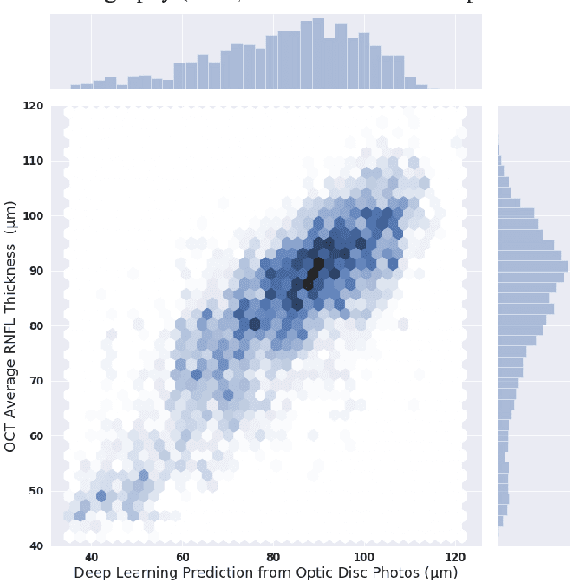 Figure 2 for From Machine to Machine: An OCT-trained Deep Learning Algorithm for Objective Quantification of Glaucomatous Damage in Fundus Photographs