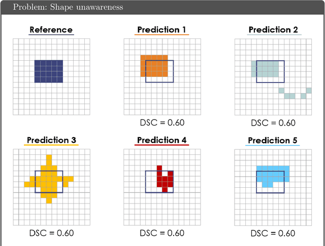 Figure 4 for Common Limitations of Image Processing Metrics: A Picture Story