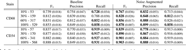 Figure 2 for Self adversarial attack as an augmentation method for immunohistochemical stainings