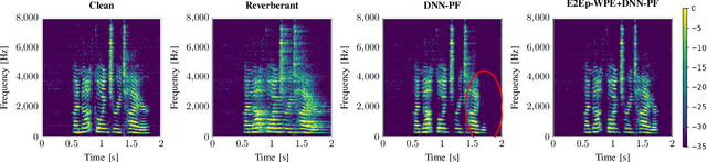 Figure 4 for End-To-End Optimization of Online Neural Network-supported Two-Stage Dereverberation for Hearing Devices