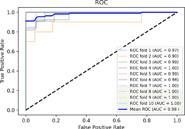 Figure 4 for Early heart disease prediction using hybrid quantum classification