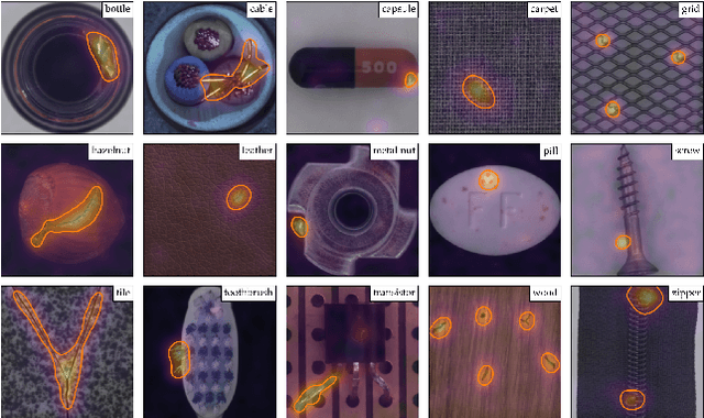 Figure 1 for Towards Total Recall in Industrial Anomaly Detection