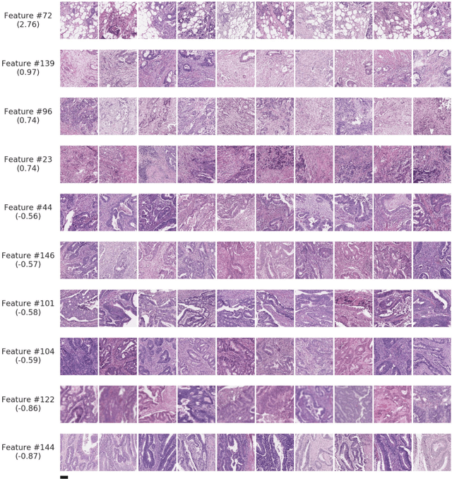Figure 3 for Interpretable Survival Prediction for Colorectal Cancer using Deep Learning