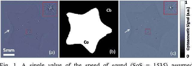 Figure 1 for Visual Quality Enhancement in Optoacoustic Tomography using Active Contour Segmentation Priors