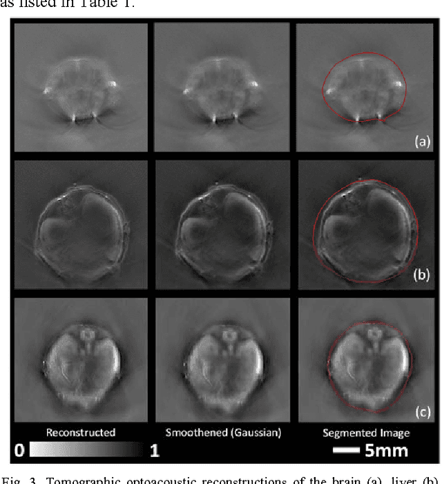 Figure 3 for Visual Quality Enhancement in Optoacoustic Tomography using Active Contour Segmentation Priors