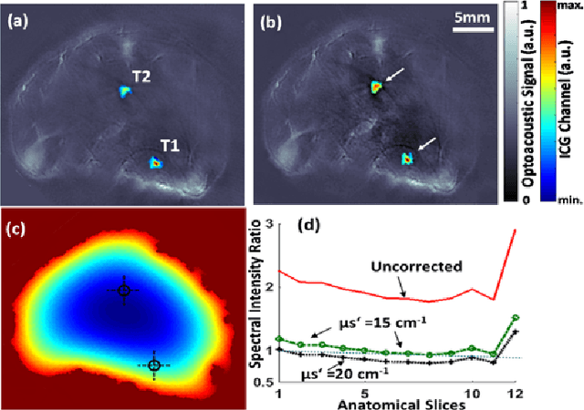 Figure 4 for Visual Quality Enhancement in Optoacoustic Tomography using Active Contour Segmentation Priors