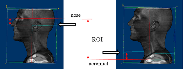 Figure 4 for A Gradient Mapping Guided Explainable Deep Neural Network for Extracapsular Extension Identification in 3D Head and Neck Cancer Computed Tomography Images