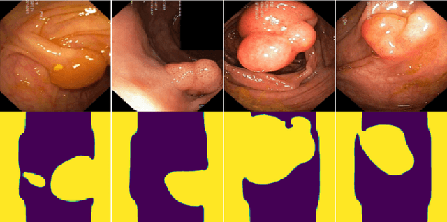 Figure 2 for Segmentation Consistency Training: Out-of-Distribution Generalization for Medical Image Segmentation