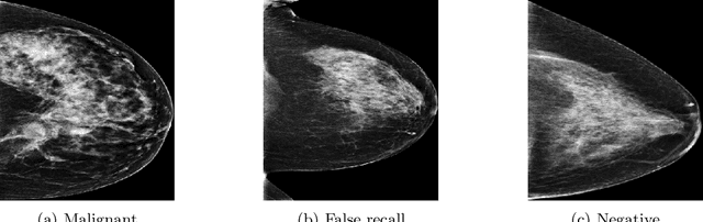 Figure 1 for Deep Curriculum Learning in Task Space for Multi-Class Based Mammography Diagnosis
