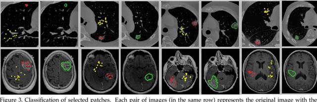 Figure 4 for Self-Attention Capsule Networks for Image Classification