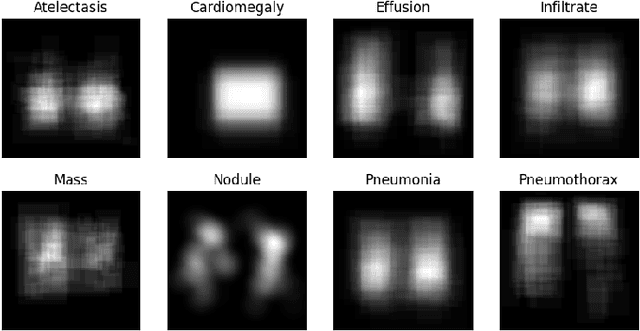 Figure 3 for A Novel Attention Mechanism Using Anatomical Prior Probability Maps for Thoracic Disease Classification from X-Ray Images