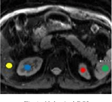 Figure 1 for SUPER-IVIM-DC: Intra-voxel incoherent motion based Fetal lung maturity assessment from limited DWI data using supervised learning coupled with data-consistency