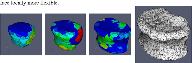 Figure 3 for A New 3D Method to Segment the Lumbar Vertebral Bodies and to Determine Bone Mineral Density and Geometry