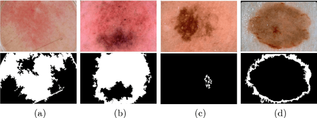 Figure 1 for Automatic Skin Lesion Segmentation Using Deep Fully Convolutional Networks