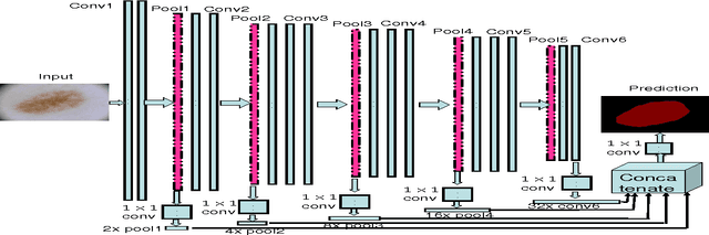 Figure 2 for Global and Local Information Based Deep Network for Skin Lesion Segmentation