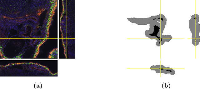Figure 4 for 3D U-Net: Learning Dense Volumetric Segmentation from Sparse Annotation