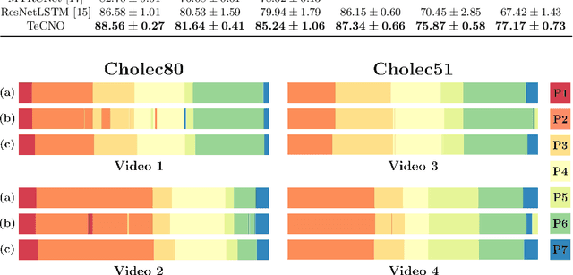 Figure 4 for TeCNO: Surgical Phase Recognition with Multi-Stage Temporal Convolutional Networks