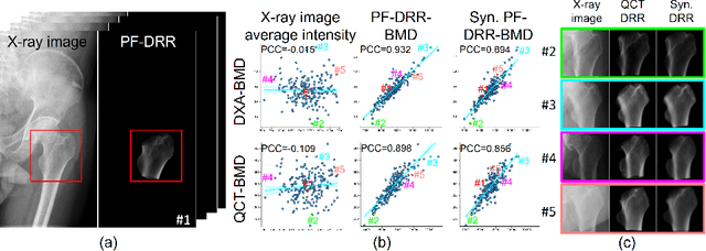 Figure 4 for BMD-GAN: Bone mineral density estimation using x-ray image decomposition into projections of bone-segmented quantitative computed tomography using hierarchical learning