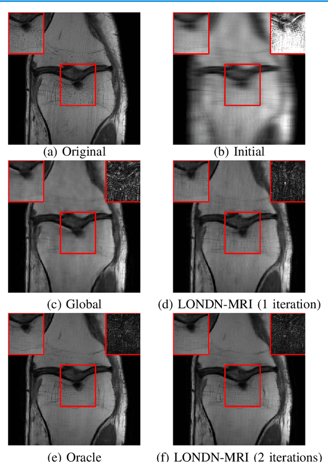 Figure 4 for Adaptive Local Neighborhood-based Neural Networks for MR Image Reconstruction from Undersampled Data