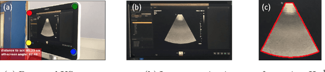 Figure 2 for Screen Tracking for Clinical Translation of Live Ultrasound Image Analysis Methods