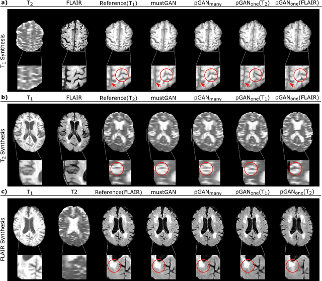 Figure 3 for mustGAN: Multi-Stream Generative Adversarial Networks for MR Image Synthesis