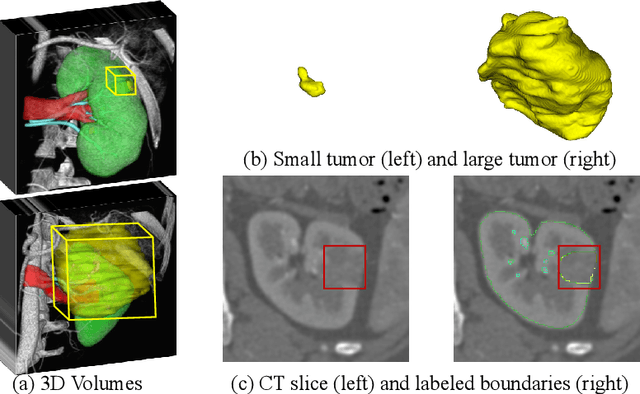 Figure 1 for Boundary-Aware Network for Kidney Parsing