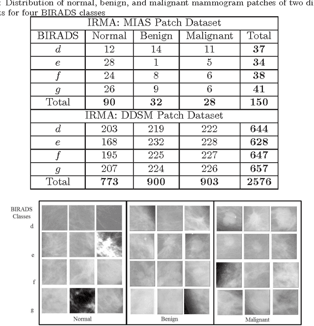 Figure 1 for Density-Wise Two Stage Mammogram Classification using Texture Exploiting Descriptors