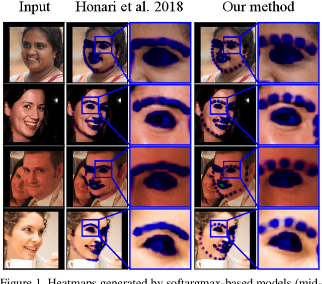 Figure 1 for Laplace Landmark Localization