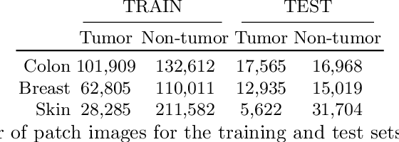 Figure 1 for Primary Tumor and Inter-Organ Augmentations for Supervised Lymph Node Colon Adenocarcinoma Metastasis Detection