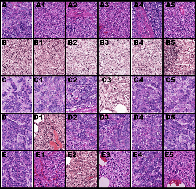 Figure 4 for Self-Supervised Similarity Learning for Digital Pathology