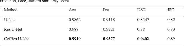 Figure 3 for RA V-Net: Deep learning network for automated liver segmentation