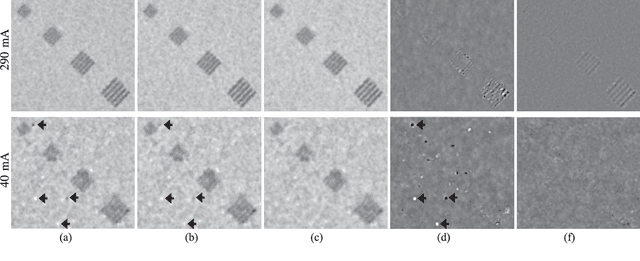 Figure 4 for A Gaussian Mixture MRF for Model-Based Iterative Reconstruction with Applications to Low-Dose X-ray CT