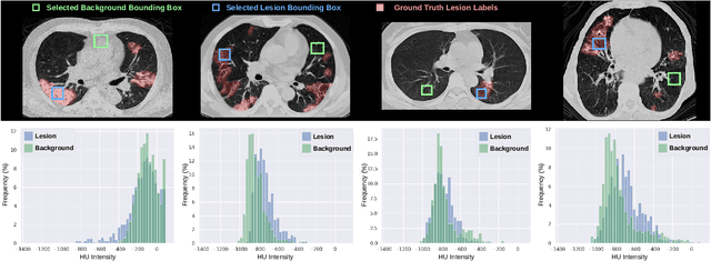 Figure 1 for ECONet: Efficient Convolutional Online Likelihood Network for Scribble-based Interactive Segmentation