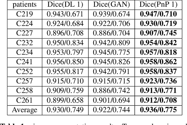 Figure 2 for To what extent can Plug-and-Play methods outperform neural networks alone in low-dose CT reconstruction