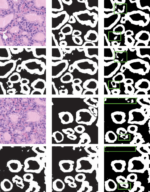 Figure 4 for Residual Pyramid FCN for Robust Follicle Segmentation