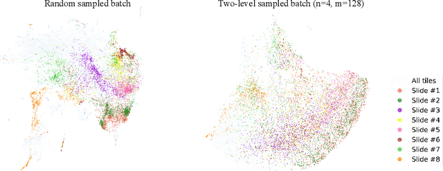 Figure 1 for Interpretable Prediction of Lung Squamous Cell Carcinoma Recurrence With Self-supervised Learning