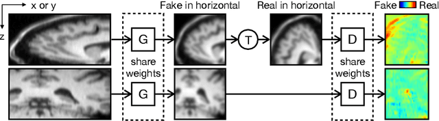 Figure 1 for MR Slice Profile Estimation by Learning to Match Internal Patch Distributions