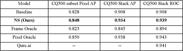 Figure 2 for Noisy Student learning for cross-institution brain hemorrhage detection