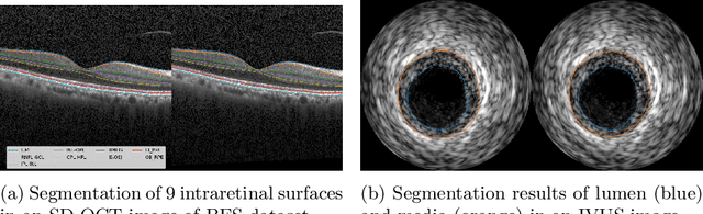 Figure 2 for Globally Optimal Segmentation of Mutually Interacting Surfaces using Deep Learning