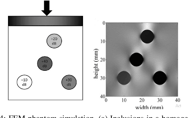 Figure 4 for Imrpoving Strain Estimation in Breast Ultrasound Images Using Novel 1.5D Approach (Simulation and In-vivo results