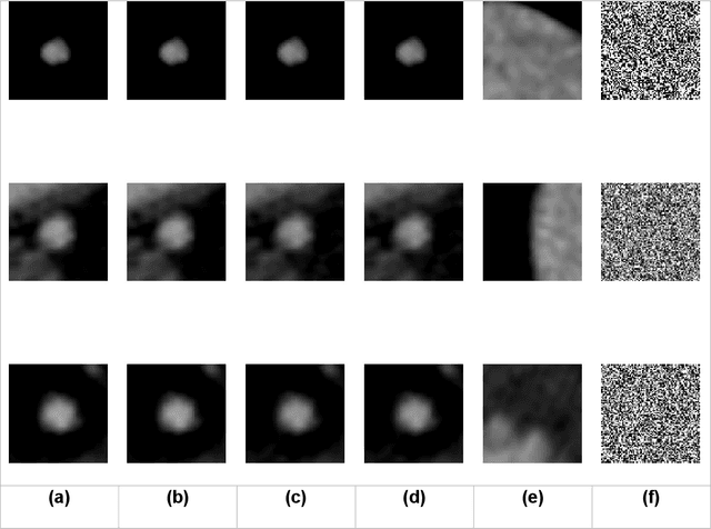 Figure 4 for Unsupervised Abnormality Detection through Mixed Structure Regularization (MSR) in Deep Sparse Autoencoders