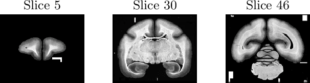 Figure 1 for Variational Registration of Multiple Images with the SVD based SqN Distance Measure