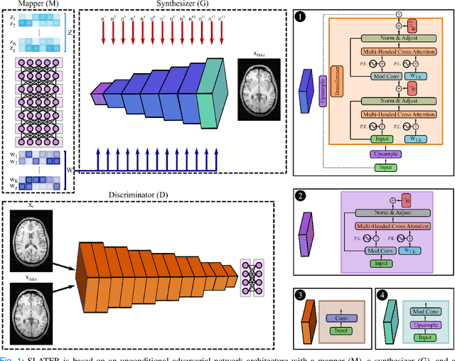 Figure 1 for Unsupervised MRI Reconstruction via Zero-Shot Learned Adversarial Transformers