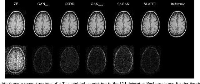 Figure 4 for Unsupervised MRI Reconstruction via Zero-Shot Learned Adversarial Transformers