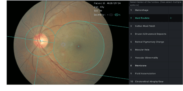 Figure 1 for Classification of Findings with Localized Lesions in Fundoscopic Images using a Regionally Guided CNN
