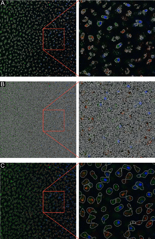 Figure 2 for A watershed-based algorithm to segment and classify cells in fluorescence microscopy images