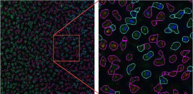 Figure 3 for A watershed-based algorithm to segment and classify cells in fluorescence microscopy images